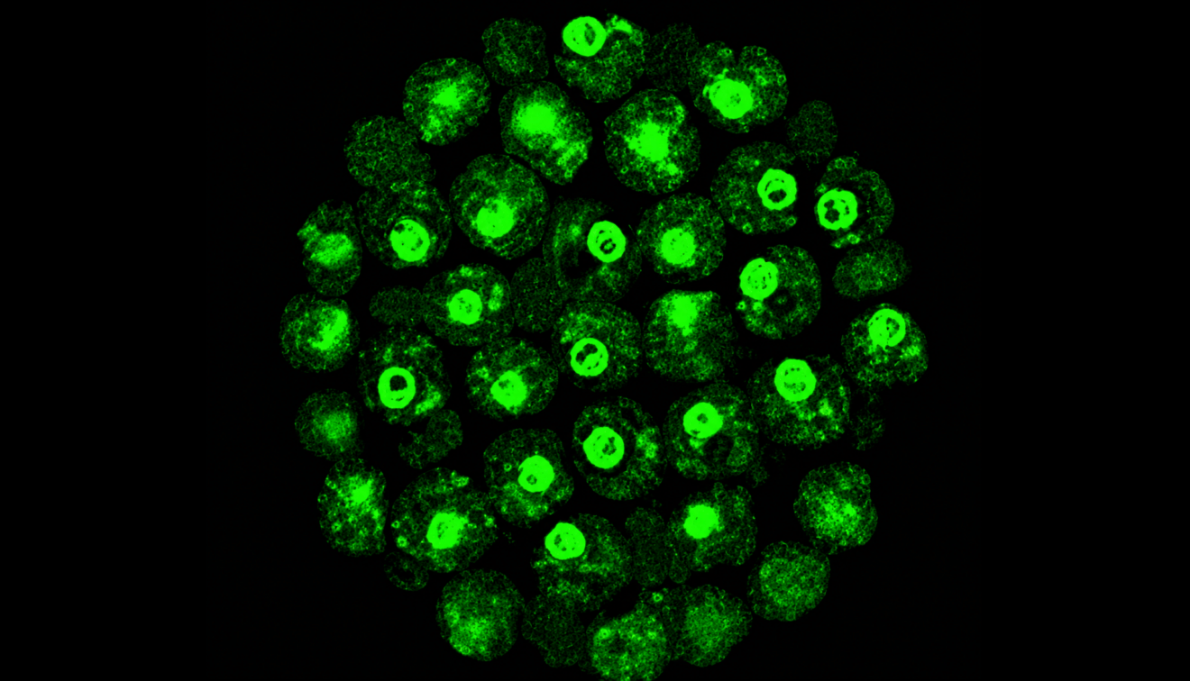 Analyse et caractérisation des biofilms - Projet de recherche du LabISEN